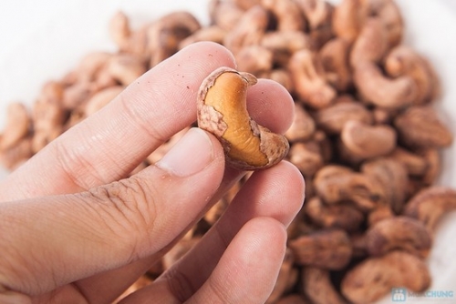 6 tác dụng tuyệt diệu của hạt điều với sức khỏe